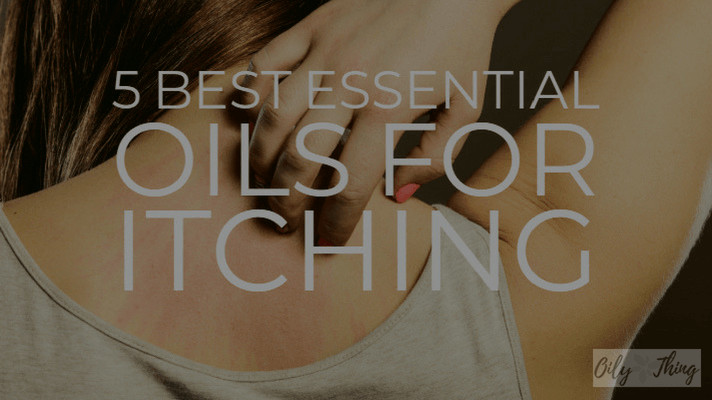 5 Best Essential Oils for Itching Article Featured Image
