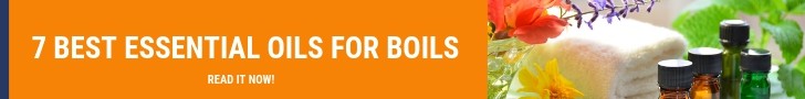 7 best essential oils for boils banner ad